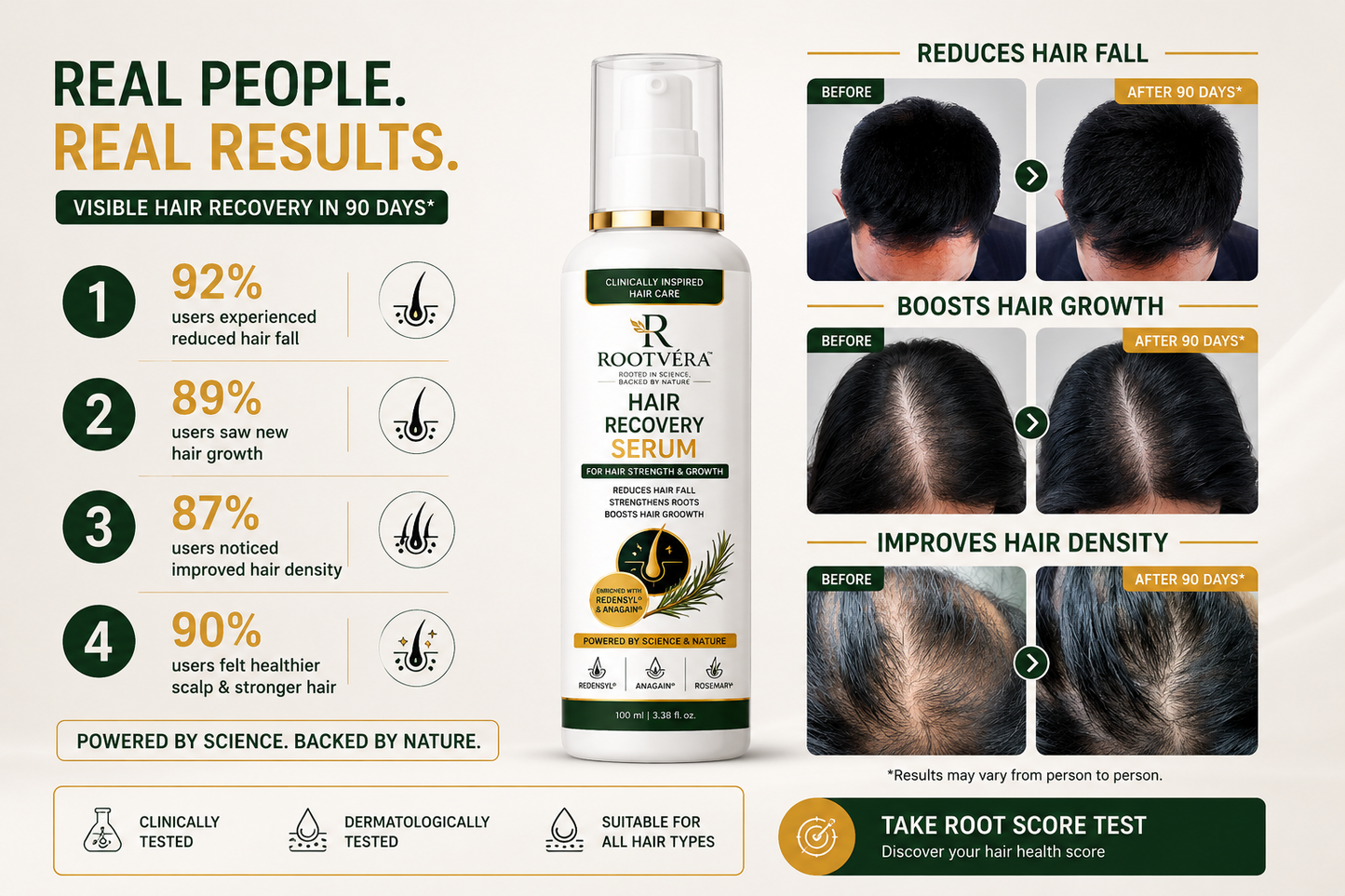 ROOTVERA HAIR REGROWTH SERUM |3% Redensyl + 4%  Anagain + Rosemary | Overnight scalp spray for hair fall | 100 ml